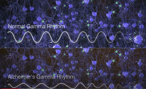 40Hz gamma golven in hersenen